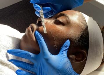 Dermaplaning_Moment