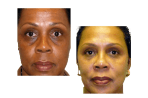 Fillers_clipped_rev_1 Fillers_clipped_rev_1
