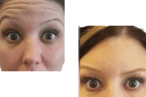 injectables injectables